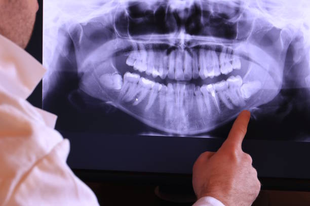 Best Chipped Tooth Repair Near Me  in Indian Rocks Beach, FL